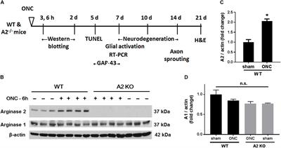 Retinal Neuroprotection From Optic Nerve Trauma by Deletion of Arginase 2